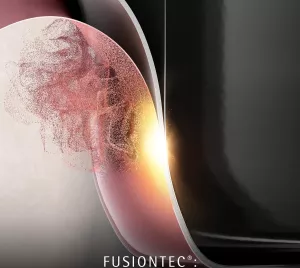Sada hrnců WMF FUSIONTEC Mineral Pro 4 ks, růžová
